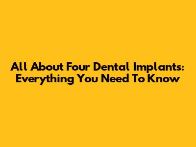 All About Four Dental Implants: Everything You Need To Know