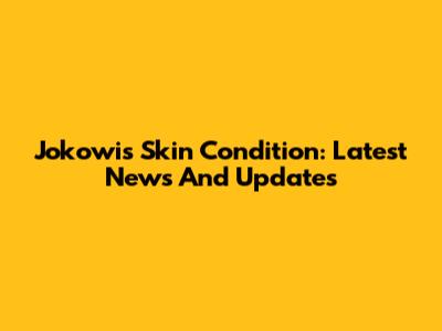Jokowi's Skin Condition: Latest News And Updates