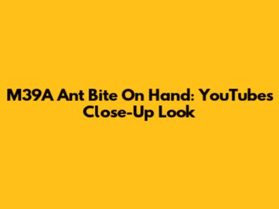 M39A Ant Bite On Hand: YouTube's Close-Up Look