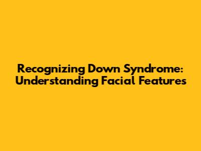 Recognizing Down Syndrome: Understanding Facial Features