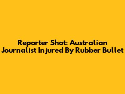 Reporter Shot: Australian Journalist Injured By Rubber Bullet