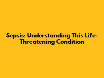 Sepsis: Understanding This Life-Threatening Condition